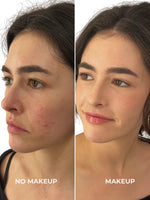 pack teint parfait peau médium - maquillage naturel et bio avant/après